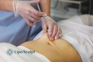 Does Skin Sag After Fat Dissolving Injections? 2 Do you want to get Aqualyx fat dissolving injections Hampton in Arden but worried about loose skin afterwards?