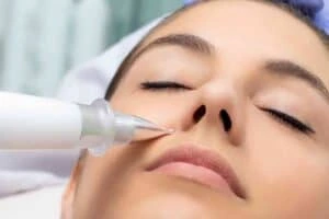 Best Actinic Keratoses Removal 3 Actinic keratoses Hampton in Arden solutions - book in today!